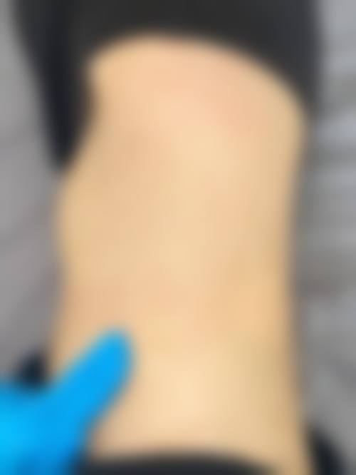 河南商丘昕瑶整形医院口碑好不好？附真实患者口碑评价