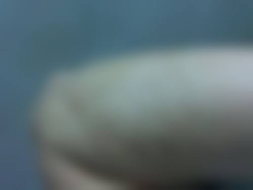 罗谦医生简介项目优势