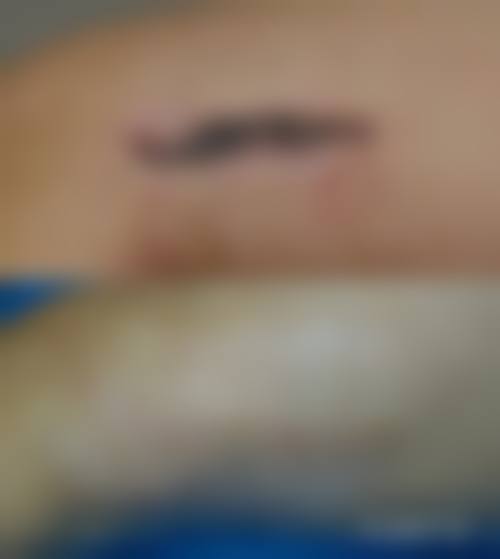 曹长源医生简介之口碑如何