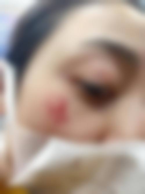 林柱焕医生简介做手术价格