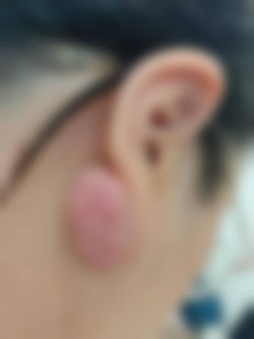 长春华瑷美容医院口碑好不好？附真实患者口碑评价