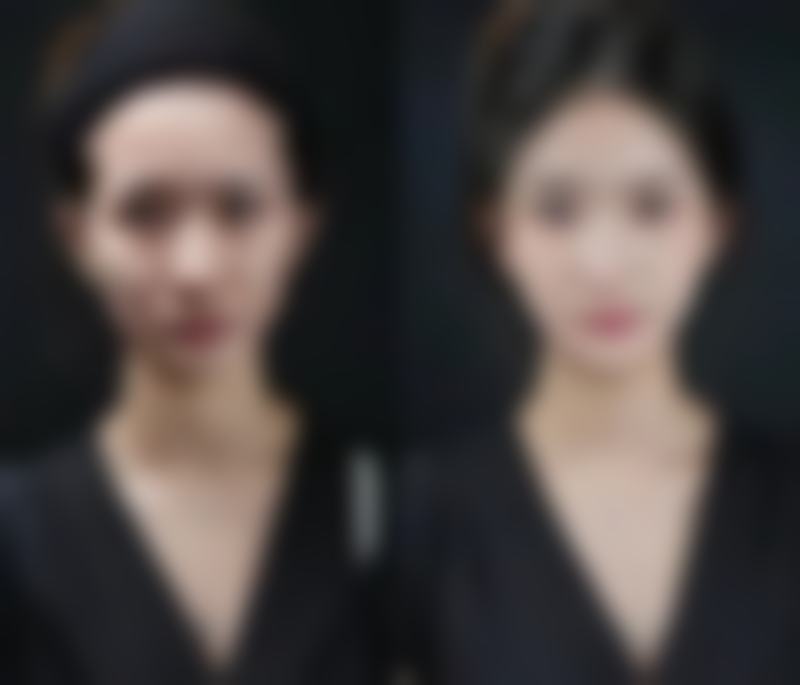 苏州凯思米整形医院口碑好不好?附真实患者口碑评价