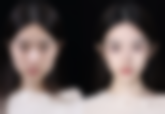 曹长源医生治疗项目优势