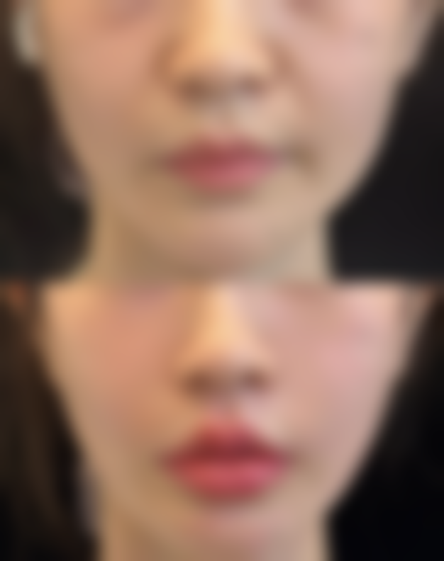 南京优俪智美医疗美容诊所价格表