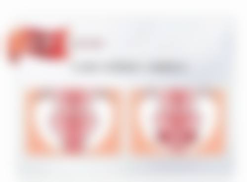 怎么可以让三眼皮变回双眼皮——成都肖阿能医生处