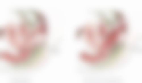 割了双眼皮后遗症修复时间表