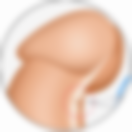 一、抽脂手术有危险吗？