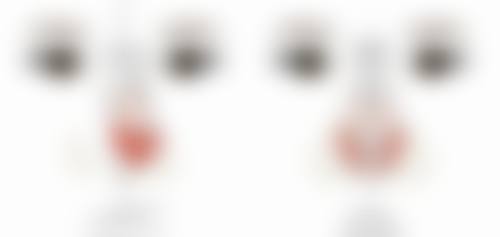 抽脂填胸有什么副作用：脂肪液化——脂肪细胞的“罢工”现象