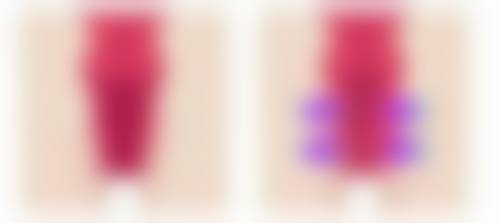 豆浆虽好，适量为妙，谨遵医嘱焕美颜