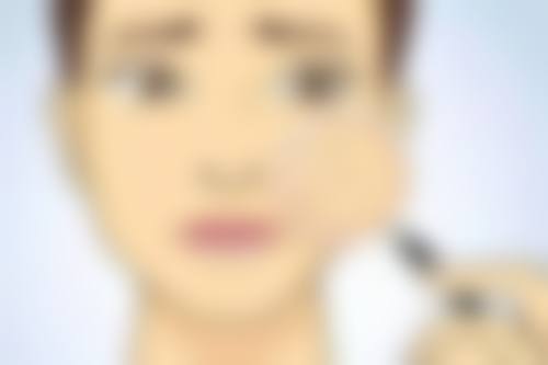 处女膜修复：医院见证疤痕消失历程