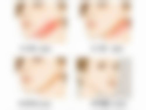 抽脂填胸有什么副作用：血肿——皮下的小型“血库”