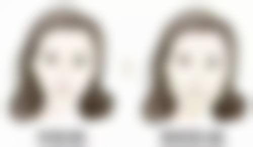 大腿吸脂之后过早同房的危害