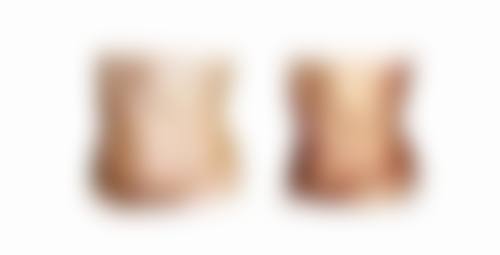 张大维医生做手术价格