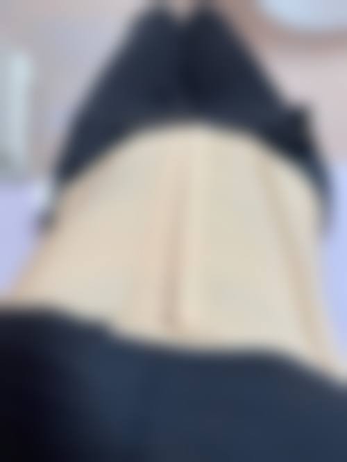 面部抽脂一般要多少——北京奥尔贝德医疗美容门诊部