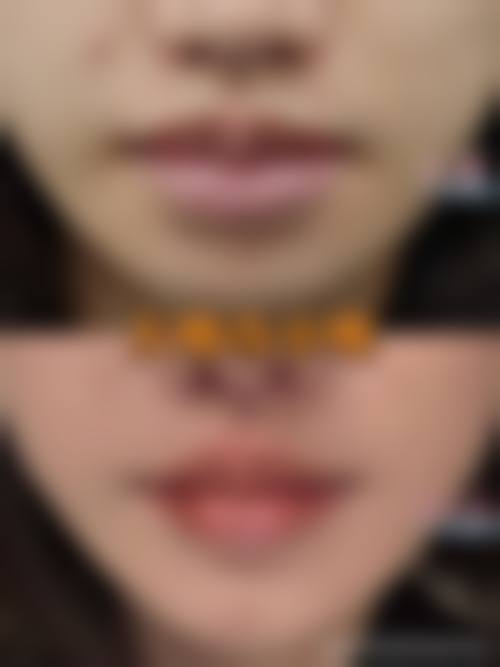 宁德蕉城仁禾日季整形医院价格表