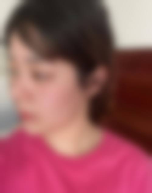 嘉善优肤可丽整形医院口碑好不好及真实患者评价