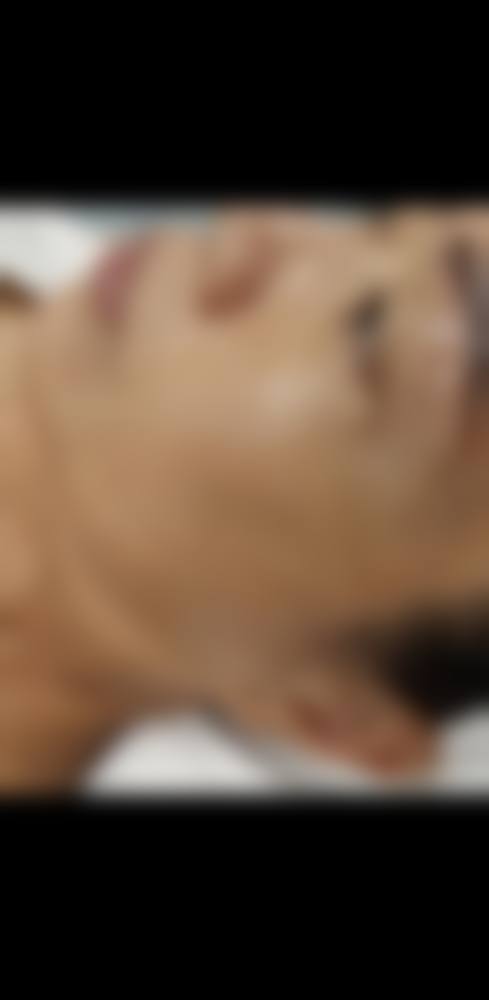 李东山医生项目优势