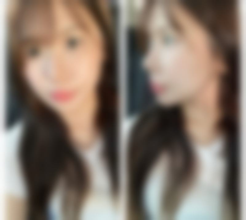 打瘦脸针可以吃柚子吗——北京臻悦医疗美容门诊部(望京店)