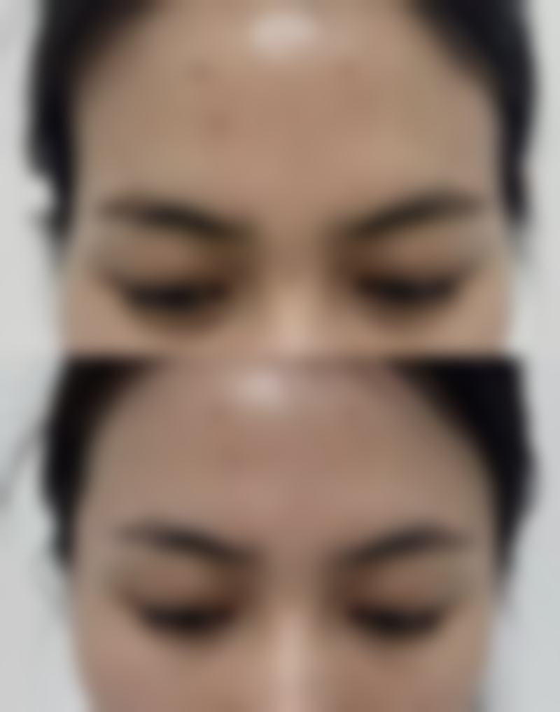 告别眼袋，焕发青春光彩！