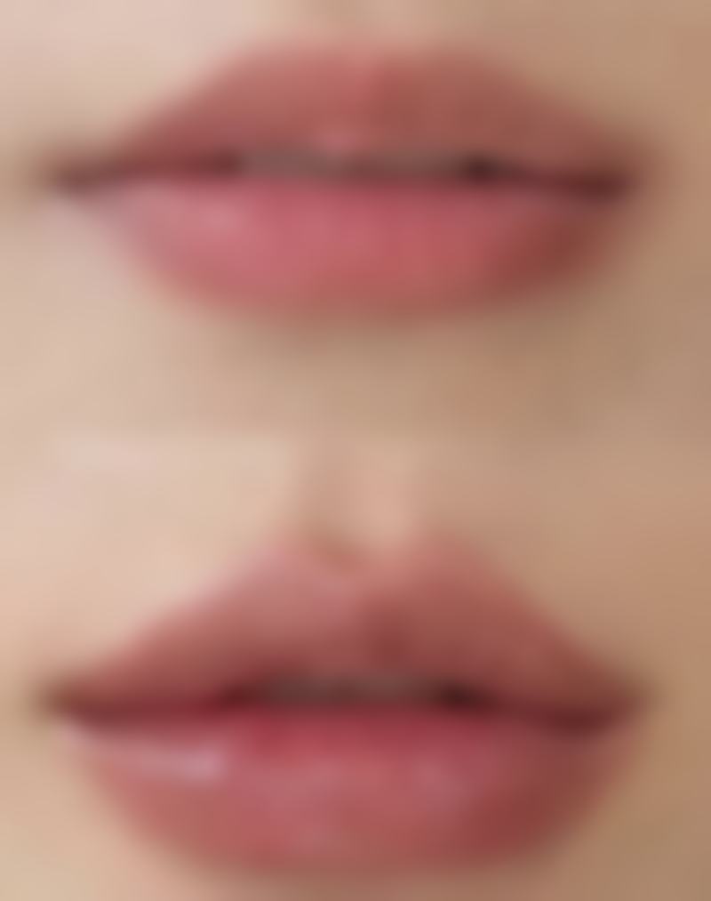 大腿吸脂价格参考