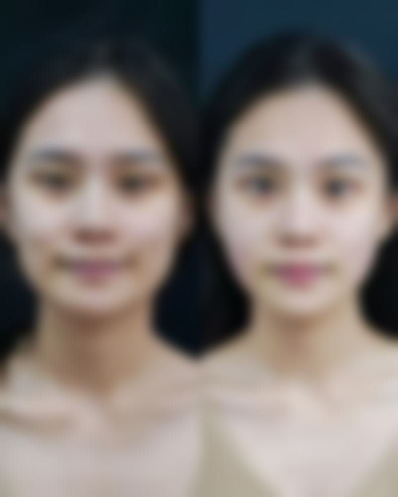 李东山医生口碑如何