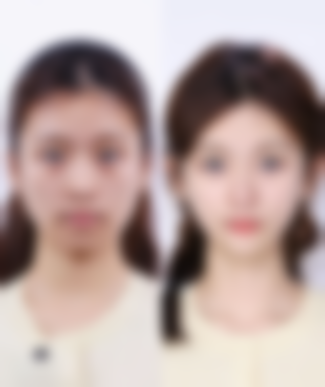 处女膜修复手术：医院把关与个人体质对疤痕的作用