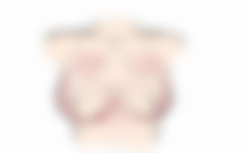 怎么辨别隆胸和真胸——长沙爱思特整形