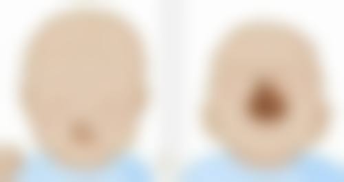 科学治疗：打破增生循环的关键——专精医疗手段盘点