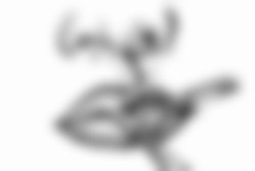 乳房大抽脂的医院保护与反弹情况