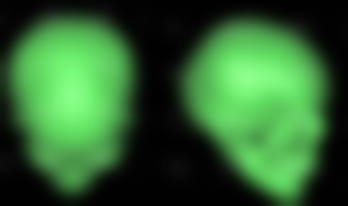 做双眼皮手术会有危险吗之不同手术方式的风险差异——三点定位法：日式精细之美