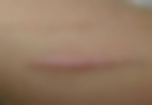 生姜敷眼袋的正确操作法