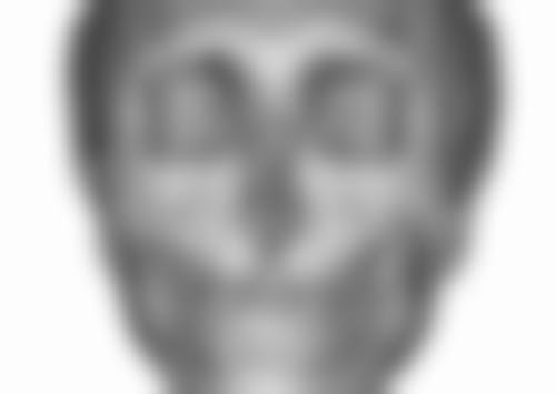 做双眼皮手术会有危险吗之术后护理要点——拆线前的“清规戒律”