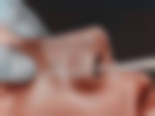 隆鼻硅胶膨体哪个好——上海联合丽格