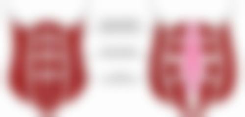 双眼皮割后多久可以修复——鞍山美容医院阐述