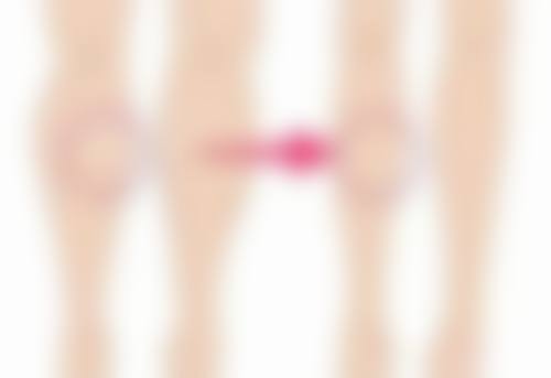 告别凸出疤痕，重获光滑肌肤