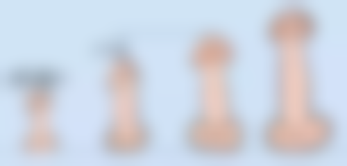 凸出疤痕怎样变平？三甲医院激光治疗+药物涂抹双管齐下最有效