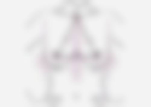 隆胸的假体会破吗之硅胶假体老化风险