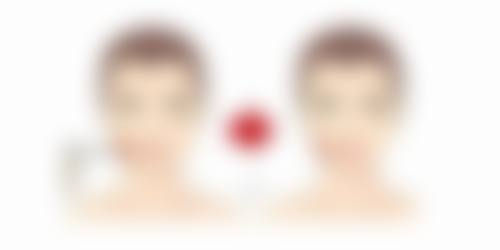 患者更关心的5个问题