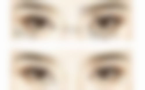 生姜敷眼袋的副作用警示