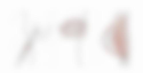 疤痕疙瘩会慢慢的自己消退吗——时间并非万能解药