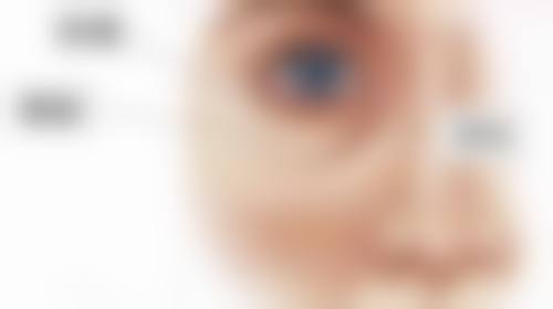 做双眼皮手术会有危险吗之特殊人群避雷指南——眼皮松弛的熟龄肌