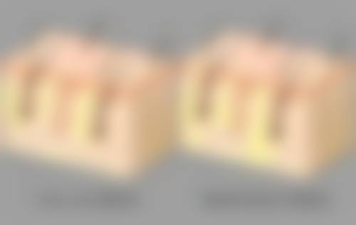 做双眼皮手术会有危险吗之特殊人群避雷指南——肿眼泡星人