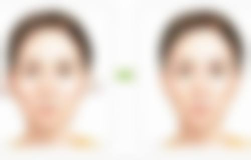 大腿吸脂后特殊情况处理指南