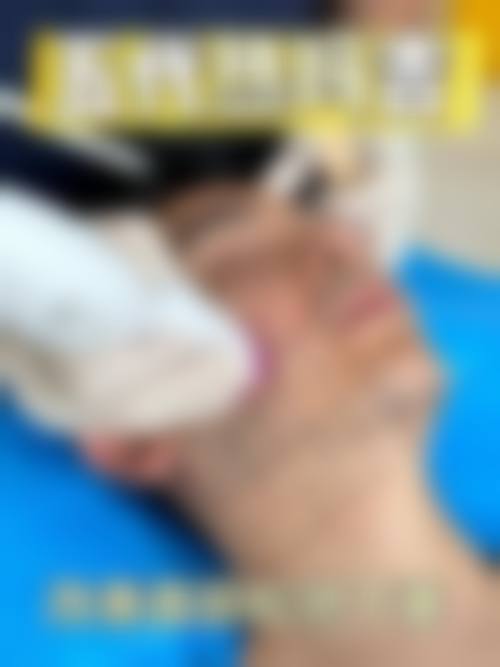 李东山医生简介项目优势