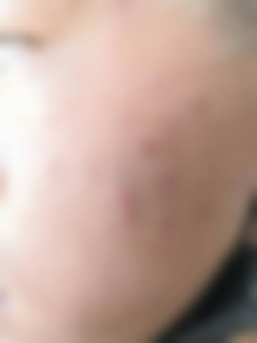 于红敏医生简介：做手术价格