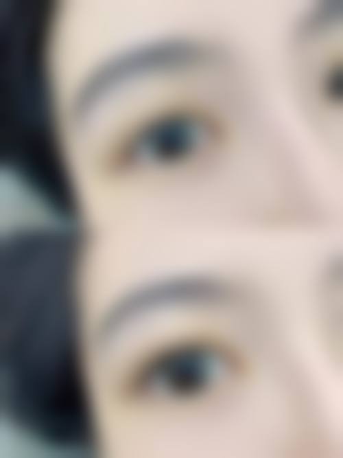 西安碧莲盛植发诊所怎么样，更擅长什么