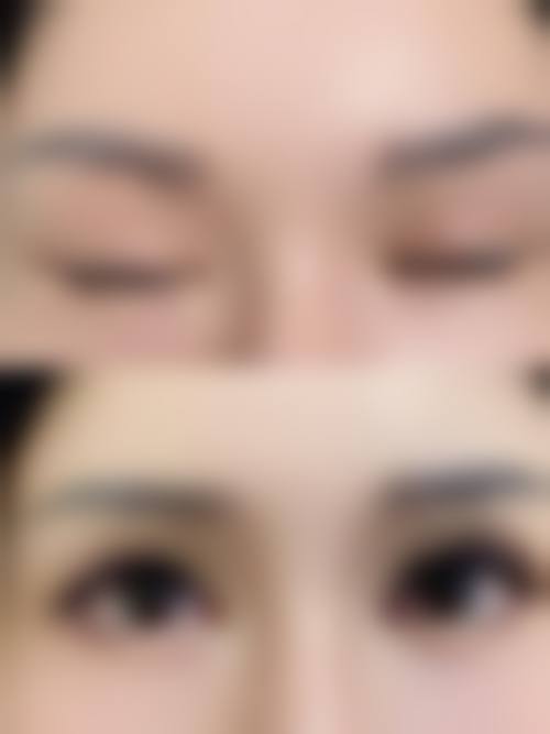 西安碧莲盛植发诊所怎么样，怎么挂号，地址在哪儿