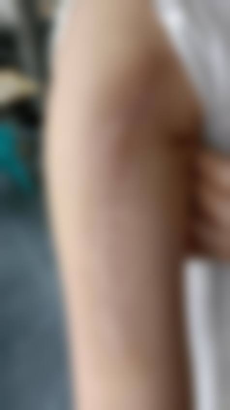 沈余明医生口碑如何