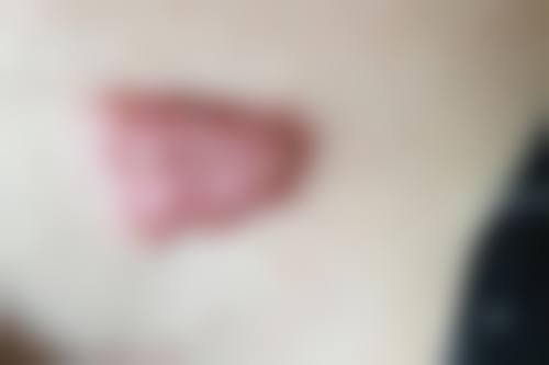 乌鲁木齐瑞与瑞医疗美容诊所怎么样：更擅长什么手术