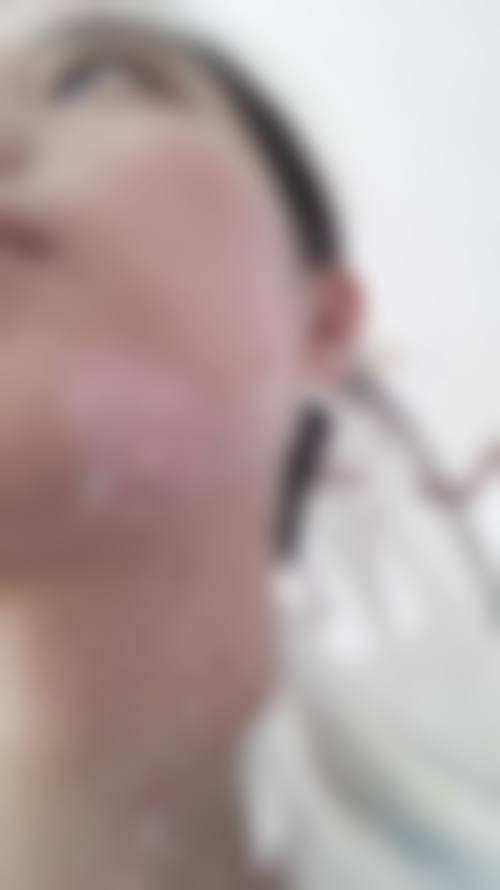 沈余明医生项目优势